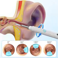 Wireless Ear cleaning tools